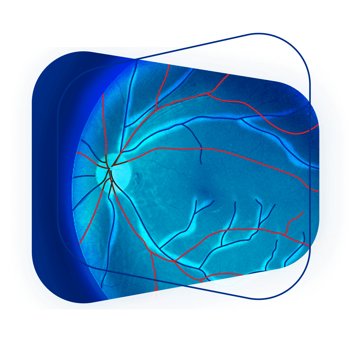 Artery Vein Segmentation AI Retinal Imaging
