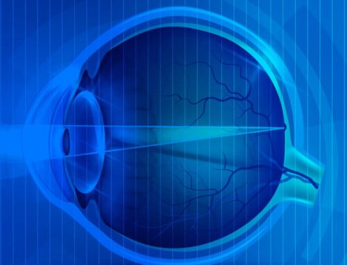 Glaucoma Screening: How AI is Improving Eye Health Checkups