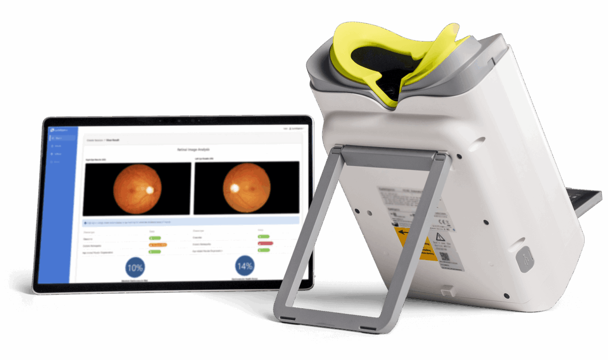AI Retinal Imaging for Early Disease Detection | Optain Health